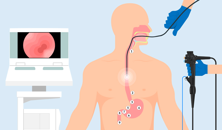 Endoscopy
